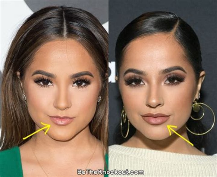 Becky G Plastic Surgery Before and After