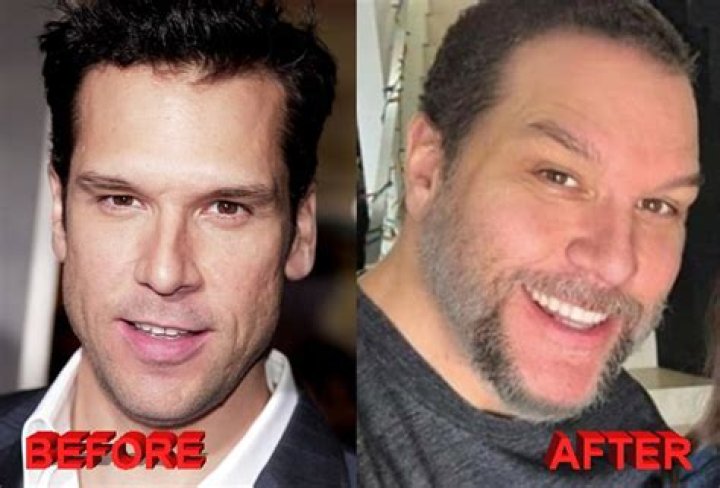 
Dane Cook’s Weight Loss Has Led Many To Believe He Has Had Plastic Surgery	