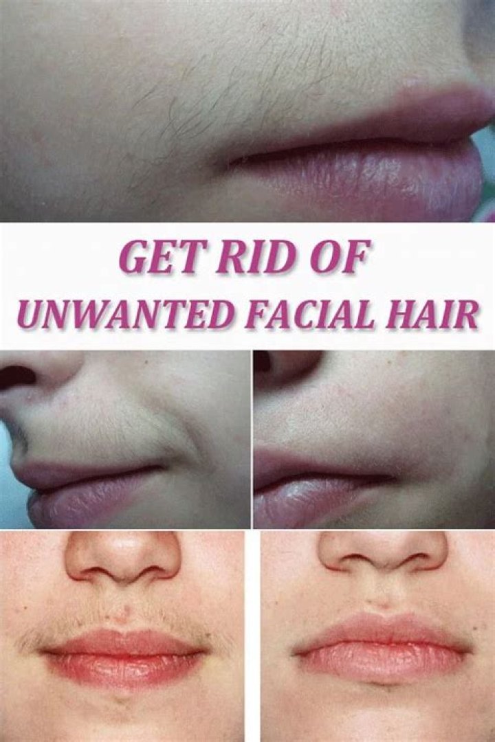 How To Get Rid Of Unwanted Facial Hair Once And For All