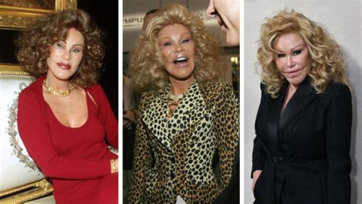 Fame | Jocelyn Wildenstein net worth and salary income estimation Jan, 2024