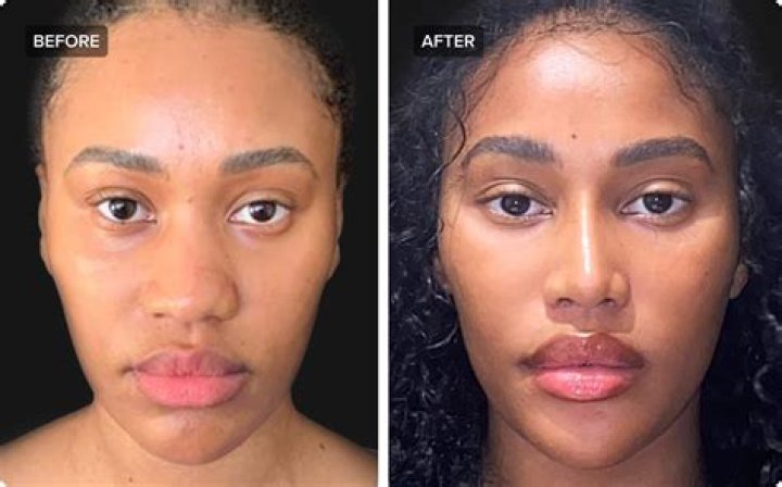 Report: Riahnna Getting A Boob Job To Please Chris Brown