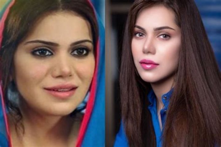 Sana Khan Plastic Surgery Before and After
