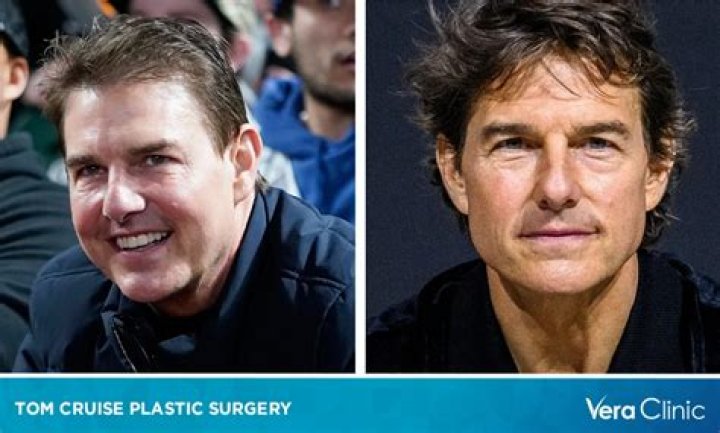 Tom Cruise Plastic Surgery: Arrives On Movie Set With New Face – Wants To Look Like First ‘Mission: Impossible’